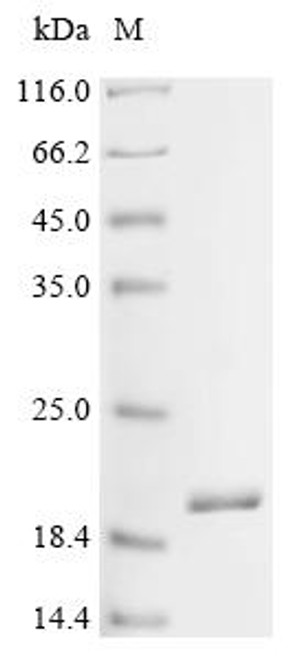 Recombinant Shigella flexneri Phospholipase A1 (pldA), partial (CSB-EP364263SZB)