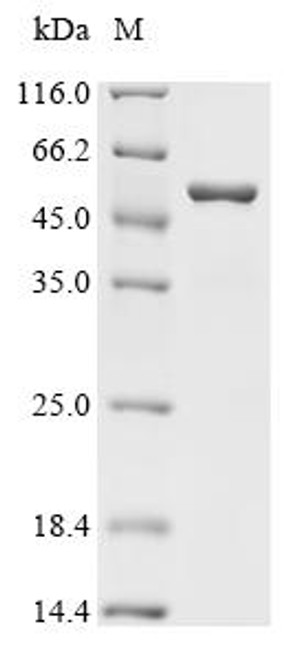 Recombinant Escherichia coli Peptide chain release factor 2 (prfB) (CSB-EP362014ENV)