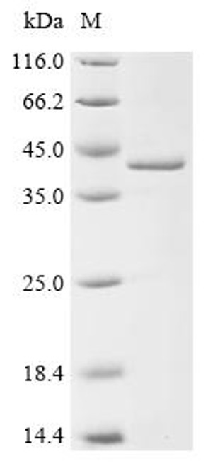 Recombinant Human Fatty acid-binding protein, liver (FABP1) (CSB-EP007940HU)