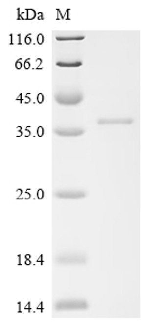 Recombinant Human Deoxyribonuclease-1-like 2 (DNASE1L2) (CSB-EP849794HU)