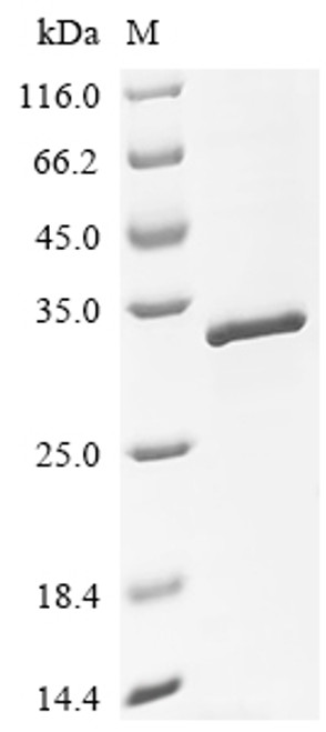 Recombinant Sheep Platelet-derived growth factor subunit B (PDGFB) (CSB-EP850135SH)
