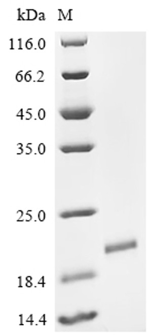 Recombinant Bovine PDGFB protein (PDGFB), Partial (CSB-EP017709BO1)