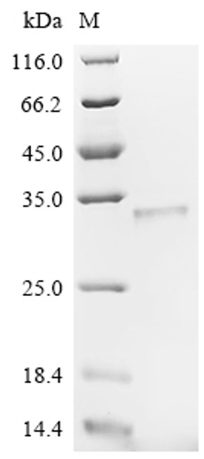 Recombinant Agrobacterium tumefaciens Single-strand DNA-binding protein (virE2), partial (CSB-EP363461AEZa0)