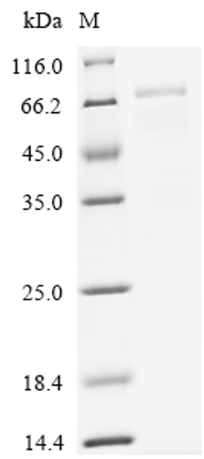 Recombinant Human Desmoglein-3 (DSG3), partial, Biotinylated (CSB-EP007205HUg2-B)