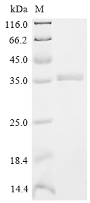 Recombinant Sus scrofa Platelet-derived growth factor subunit B (CSB-EP5629PI)