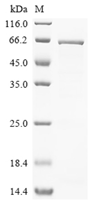 Recombinant Human Olfactomedin-like protein 1 (OLFML1) (CSB-EP740917HUe4)