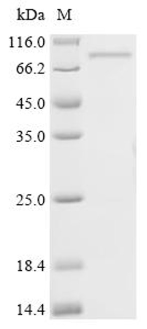 Recombinant Vaccinia virus Ankyrin repeat protein OPG025 (OPG035) (CSB-EP5597VAI)