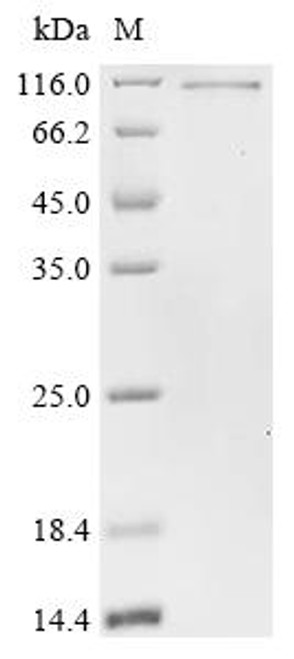Recombinant Human Fragile X mental retardation syndrome-related protein 1 (FXR1) (CSB-EP009087HU(A4)e5) Recombinant Human Fragile X mental retardation syndrome-related protein 1 (FXR1) (CSB-EP009087HU(A4)e5)