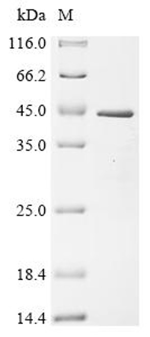 Recombinant Mouse LIM and SH3 domain protein 1 (Lasp1) (CSB-EP723427MO)