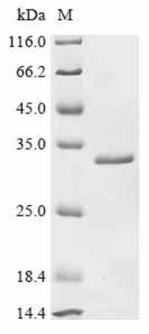Recombinant Mouse Alpha-crystallin A chain (Cryaa) (CSB-EP006007MO)