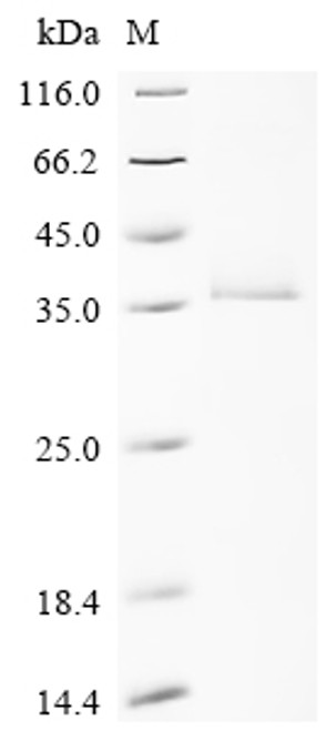 Recombinant Human Ras-related protein Rab-33A (RAB33A) (CSB-EP613485HU)