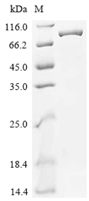 Recombinant Mouse Phosphatidylinositol 3-kinase regulatory subunit alpha (Pik3r1) (CSB-EP018003MO)