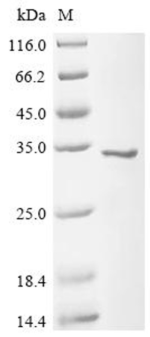 Recombinant Mouse Peroxiredoxin-6 (Prdx6) (CSB-EP018659MO)
