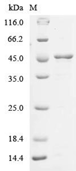 Recombinant Human Carcinoembryonic antigen-related cell adhesion molecule 1 (CEACAM1), partial (CSB-EP005157HUd7) Recombinant Human Carcinoembryonic antigen-related cell adhesion molecule 1 (CEACAM1), partial (CSB-EP005157HUd7)