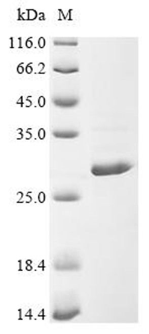 Recombinant Lupinus angustifolius Conglutin beta, partial (CSB-EP5747GWN) Recombinant Lupinus angustifolius Conglutin beta, partial (CSB-EP5747GWN)
