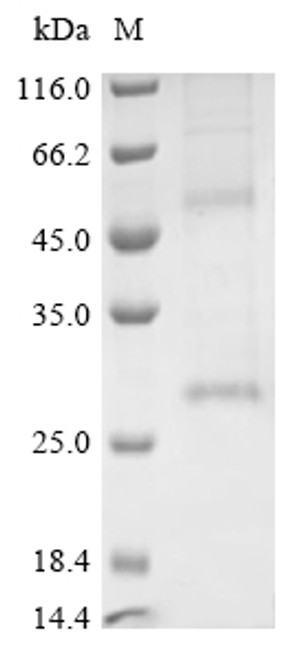 Recombinant Human Claudin-18.2 (CLDN18.2)-Detergent (Active) (CSB-MP005498HU(A5)-D) Recombinant Human Claudin-18.2 (CLDN18.2)-Detergent (Active) (CSB-MP005498HU(A5)-D)