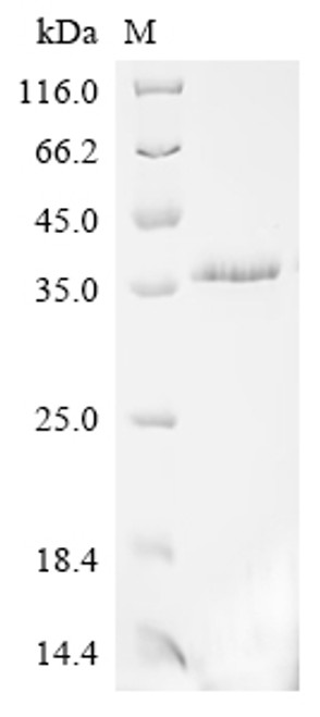 Recombinant Human B-lymphocyte antigen CD20 (MS4A1)-Detergent (Active) (CSB-MP015007HU-D) Recombinant Human B-lymphocyte antigen CD20 (MS4A1)-Detergent (Active) (CSB-MP015007HU-D)