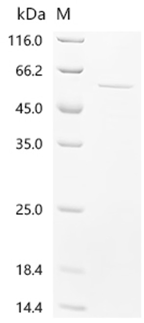Recombinant Human Casein kinase II subunit beta (CSNK2B) (CSB-EP006075HU) Recombinant Human Casein kinase II subunit beta (CSNK2B) (CSB-EP006075HU)