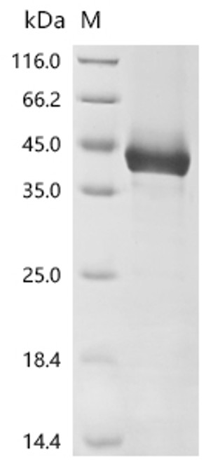 Recombinant Mouse Homeobox protein Nkx-3.2 (Nkx3-2) (CSB-EP015849MOb0) Recombinant Mouse Homeobox protein Nkx-3.2 (Nkx3-2) (CSB-EP015849MOb0)