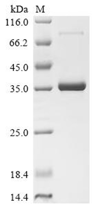 Recombinant Human Lymphocyte antigen 6E (LY6E) (Active) (CSB-MP619076HU) Recombinant Human Lymphocyte antigen 6E (LY6E) (Active) (CSB-MP619076HU)