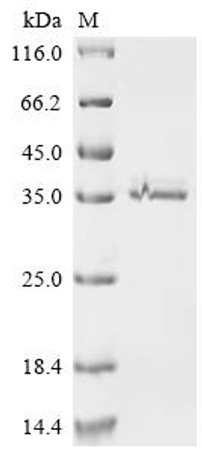Recombinant Human Retinaldehyde-binding protein 1 (RLBP1) (CSB-MP019743HU) Recombinant Human Retinaldehyde-binding protein 1 (RLBP1) (CSB-MP019743HU)