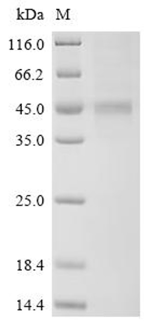Recombinant Human Interleukin-20 receptor subunit beta (IL20RB), partial (CSB-MP740921HU) Recombinant Human Interleukin-20 receptor subunit beta (IL20RB), partial (CSB-MP740921HU)