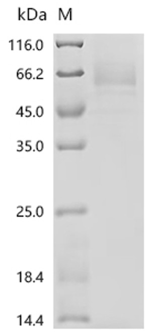 Recombinant Human Endogenous retrovirus group K member 6 Env polyprotein (ERVK-6), partial (CSB-MP724336HU1) Recombinant Human Endogenous retrovirus group K member 6 Env polyprotein (ERVK-6), partial (CSB-MP724336HU1)