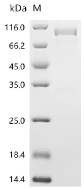 Recombinant Human Endogenous retrovirus group K member 6 Env polyprotein (ERVK-6), partial (CSB-MP724336HU1d9)