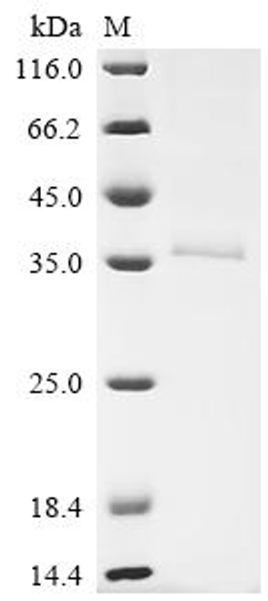 Recombinant Human Retinaldehyde-binding protein 1 (RLBP1) (CSB-BP019743HU) Recombinant Human Retinaldehyde-binding protein 1 (RLBP1) (CSB-BP019743HU)