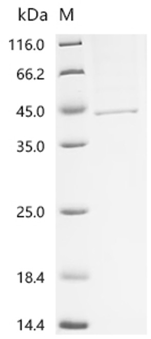 Recombinant Human Endogenous retrovirus group K member 6 Env polyprotein (ERVK-6), partial (CSB-BP724336HU1) Recombinant Human Endogenous retrovirus group K member 6 Env polyprotein (ERVK-6), partial (CSB-BP724336HU1)