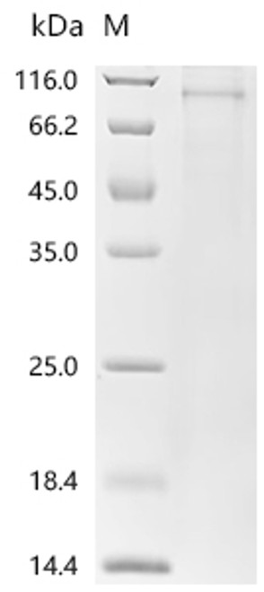 Recombinant Rat norvegicus Serine/threonine-protein kinase Chk1 (Chek1) (CSB-MP846015RAd7) Recombinant Rat norvegicus Serine/threonine-protein kinase Chk1 (Chek1) (CSB-MP846015RAd7)