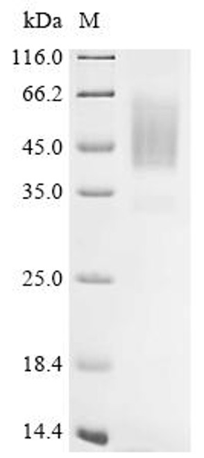 Recombinant Varicella-zoster virus Envelope glycoprotein B (gB), partial (CSB-MP678053VAQ) Recombinant Varicella-zoster virus Envelope glycoprotein B (gB), partial (CSB-MP678053VAQ)