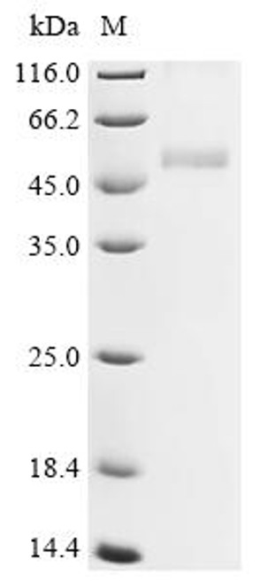 Recombinant Varicella-zoster virus Envelope glycoprotein L (gL) (CSB-MP864287VAQ) Recombinant Varicella-zoster virus Envelope glycoprotein L (gL) (CSB-MP864287VAQ)