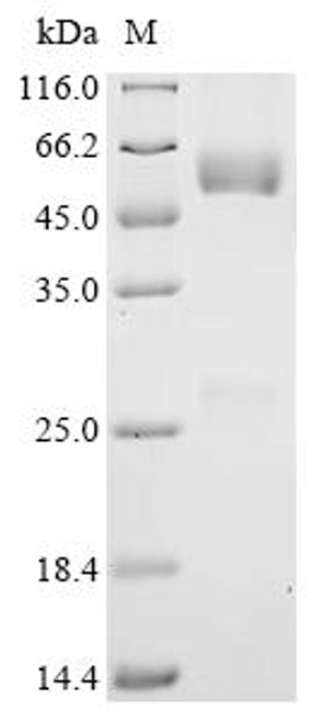Recombinant Human Metal cation symporter ZIP14 (SLC39A14), partial (CSB-MP617996HU1-T) Recombinant Human Metal cation symporter ZIP14 (SLC39A14), partial (CSB-MP617996HU1-T)