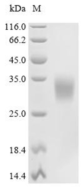 Recombinant Llama Interleukin-6 (IL6) (CSB-MP803040LBS) Recombinant Llama Interleukin-6 (IL6) (CSB-MP803040LBS)