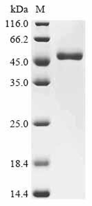 Recombinant Dog Gastric triacylglycerol lipase (LIPF) (CSB-MP012976DO) Recombinant Dog Gastric triacylglycerol lipase (LIPF) (CSB-MP012976DO)
