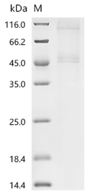 Recombinant Human Eukaryotic initiation factor 4A-I (EIF4A1) (CSB-MP007550HUd7) Recombinant Human Eukaryotic initiation factor 4A-I (EIF4A1) (CSB-MP007550HUd7)