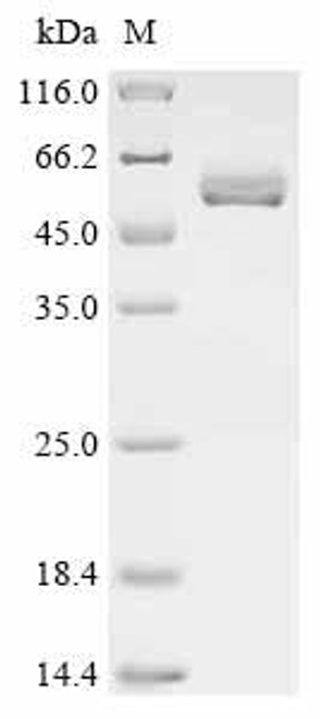 Recombinant Dog Inactive pancreatic lipase-related protein 1 (PNLIPRP1) (CSB-MP018263DO) Recombinant Dog Inactive pancreatic lipase-related protein 1 (PNLIPRP1) (CSB-MP018263DO)