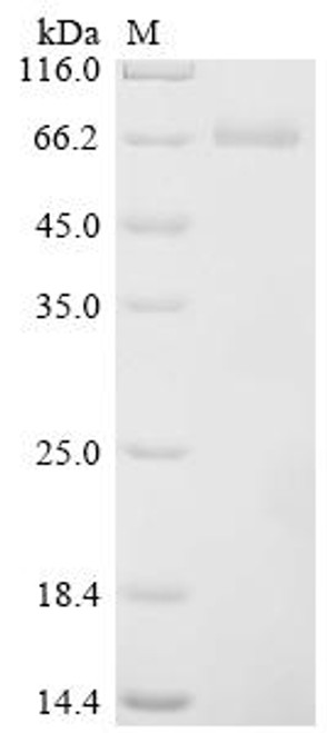 Recombinant Chapare mammarenavirus Pre-glycoprotein polyprotein GP complex (GPC), partial (CSB-MP463893DRQ1) Recombinant Chapare mammarenavirus Pre-glycoprotein polyprotein GP complex (GPC), partial (CSB-MP463893DRQ1)