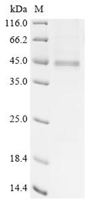 Recombinant Human CAD protein (CAD), partial (CSB-MP326741HU) Recombinant Human CAD protein (CAD), partial (CSB-MP326741HU)