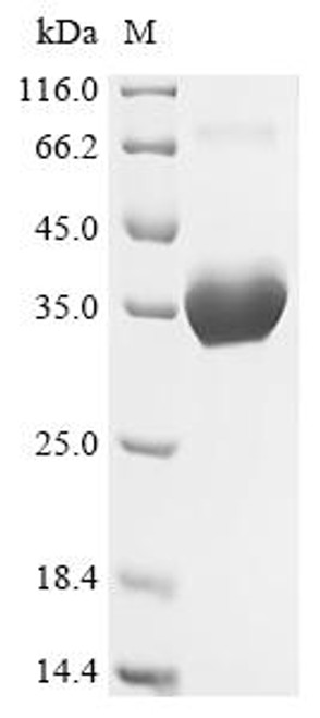 Recombinant Dermatophagoides pteronyssinus Mite allergen Der p 6 (DERP6) (X4S) (CSB-MP342212DJH) Recombinant Dermatophagoides pteronyssinus Mite allergen Der p 6 (DERP6) (X4S) (CSB-MP342212DJH)