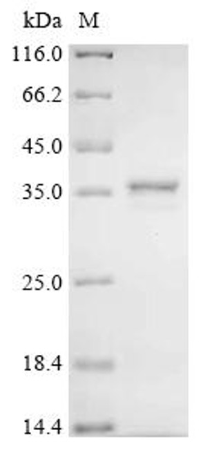 Recombinant Human Humanin-like 8(MTRNR2L8) (CSB-MP316073HU) Recombinant Human Humanin-like 8(MTRNR2L8) (CSB-MP316073HU)