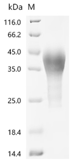 Recombinant Macaca fascicularis Leukemia inhibitory factor (LIF) (CSB-MP5062MOV) Recombinant Macaca fascicularis Leukemia inhibitory factor (LIF) (CSB-MP5062MOV)