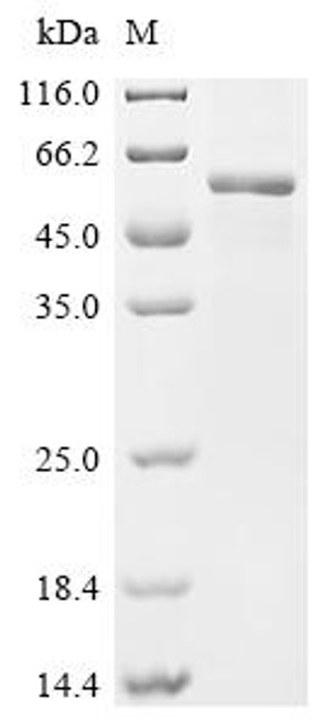 Recombinant Human E3 ubiquitin-protein ligase RNF128 (RNF128), partial (CSB-MP837448HU1) Recombinant Human E3 ubiquitin-protein ligase RNF128 (RNF128), partial (CSB-MP837448HU1)