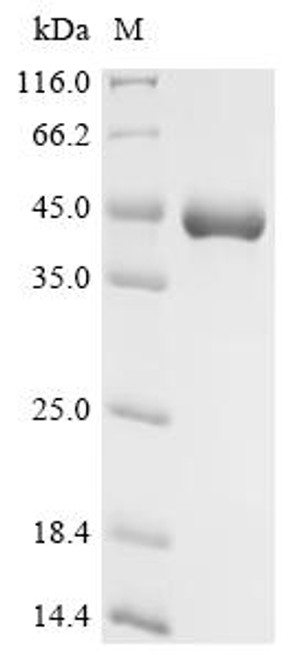 Recombinant Pandinus imperator Phospholipase A2 imperatoxin-1, partial (CSB-MP352987PAU)