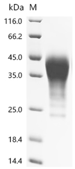 Recombinant Mouse Leukemia inhibitory factor (Lif) (CSB-MP012928MO) Recombinant Mouse Leukemia inhibitory factor (Lif) (CSB-MP012928MO)