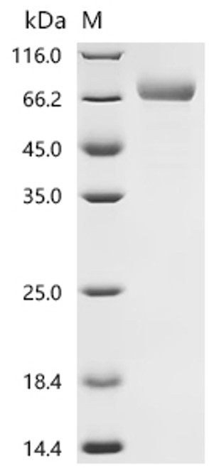 Recombinant Macaca fascicularis Leucine rich repeat containing 15 (LRRC15), partial (Active) (CSB-MP5071MOV) Recombinant Macaca fascicularis Leucine rich repeat containing 15 (LRRC15), partial (Active) (CSB-MP5071MOV)