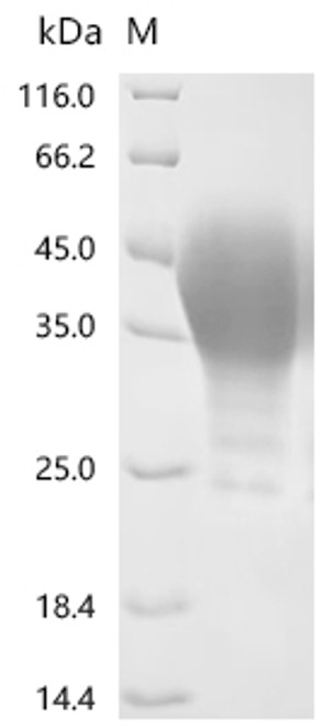 Recombinant Rat Leukemia inhibitory factor (Lif) (CSB-MP012928RA) Recombinant Rat Leukemia inhibitory factor (Lif) (CSB-MP012928RA)