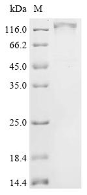 Recombinant Human Disks large homolog 4 (DLG4) (CSB-MP006938HU) Recombinant Human Disks large homolog 4 (DLG4) (CSB-MP006938HU)