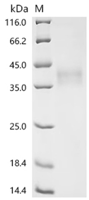 Recombinant Mouse CD276 antigen (Cd276), partial (CSB-MP848693MO) Recombinant Mouse CD276 antigen (Cd276), partial (CSB-MP848693MO)